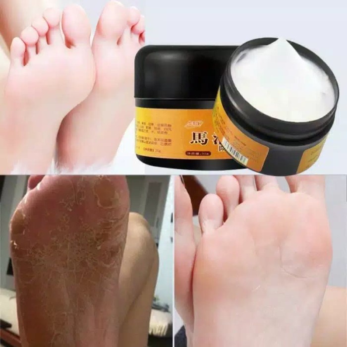 Terlaris Krim Kaki Minyak Kuda Horse Oil Untuk Kapalan Kaki Melembapkan Kulit