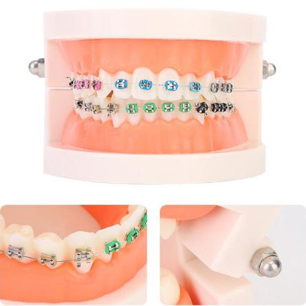 model gigi orthodontik behel gigi /phantom ortho studi model