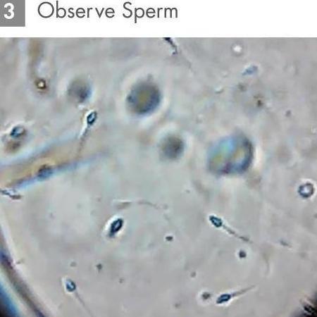 

Loupe Smartphone Sperm Observation Kit