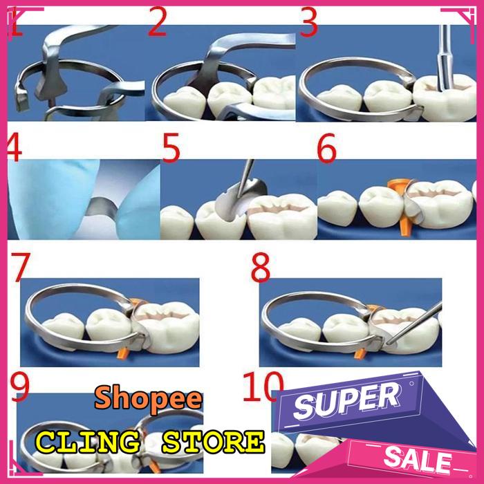 OBRAL DISKON DENTAL SADDLE MATRIX/DENTAL SECTIONAL CONTOURED MATRIX/GIGI METAL GINJAL BAND WEDGES SE