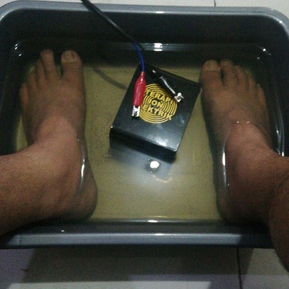 Best Seller Alat Terapi Ion Elektrik Rendam Kaki Detox 6 Array / Felialle