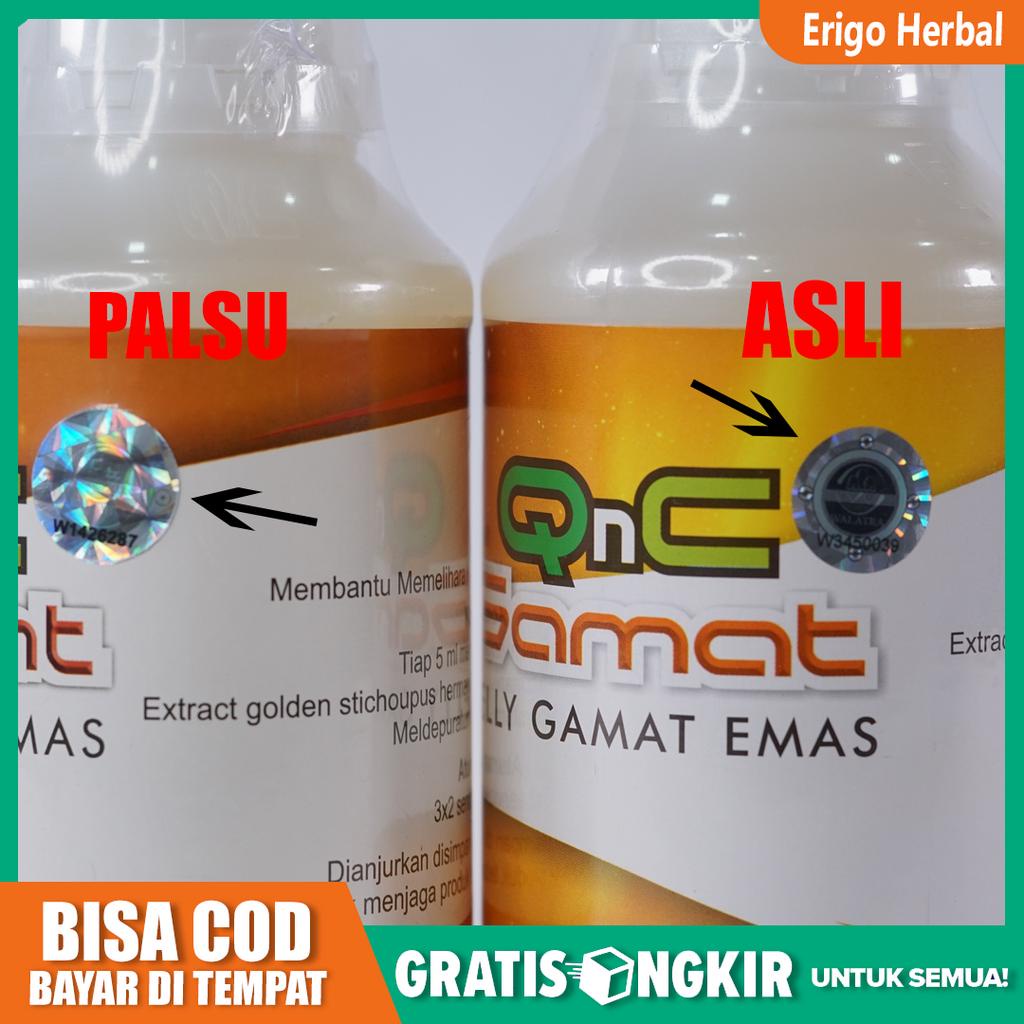 Obat Patah Tulang. Patah Tulang Dewasa, Patah Tulang Dan Retak, Tulang Keropos - QnC Jelly Gamat Ori