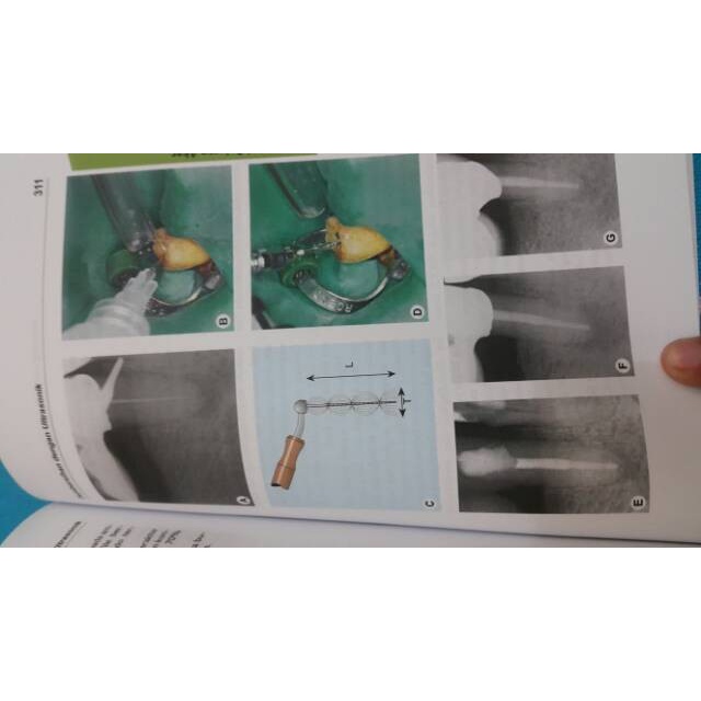 Flash Sale Buku Atlas Saku Endodontik Terlaris