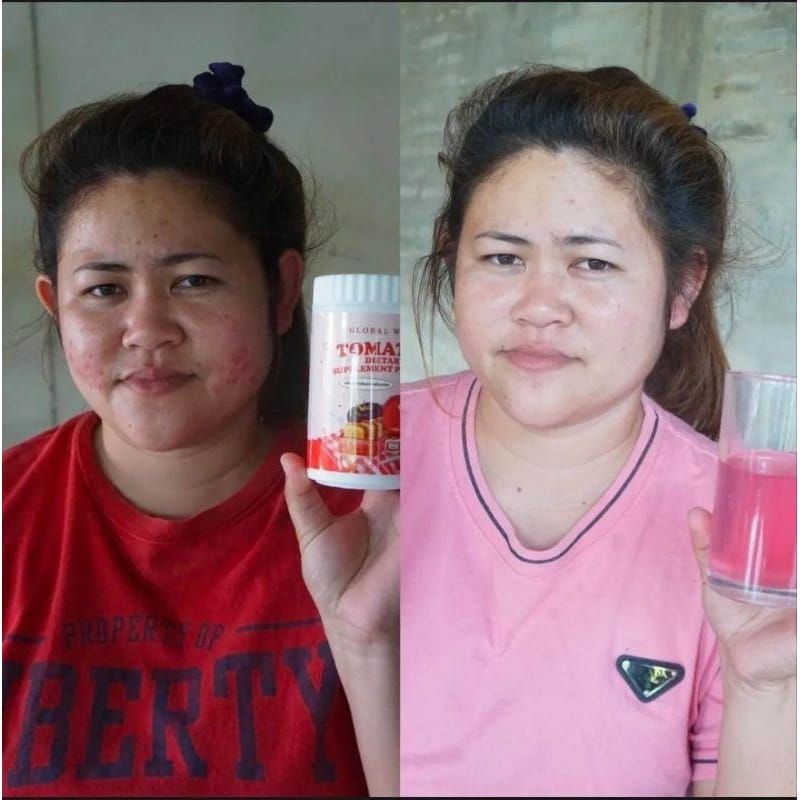 Tomatal Pelangsing Supplement/collagen/tomatal Thailand