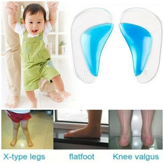 FM FIT Child Orthopedic Arch Support Insole Sol Kaki Datar Anak Flatfoot kids