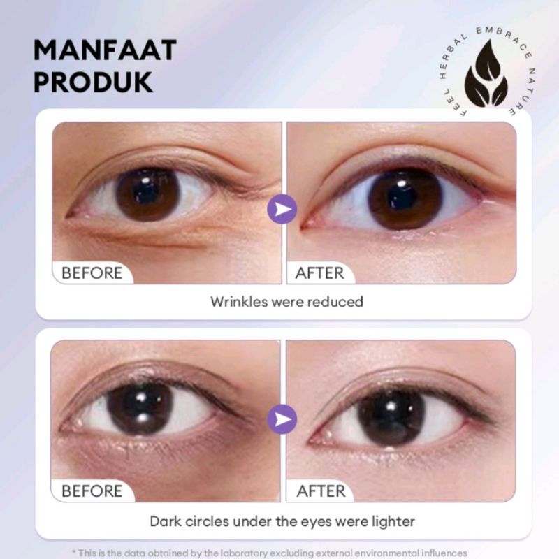 HERBAAY 3℅ RETINYL PALMITATE EYE CREAM EYE SERUM KANTUNG MATA