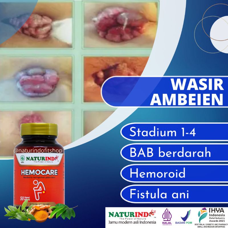 Obat Wasir Ampuh Obat Ambeien Obat Ambeyen Paling Ampuh Ambien HEMOCARE Naturindo obat wasir ampuh