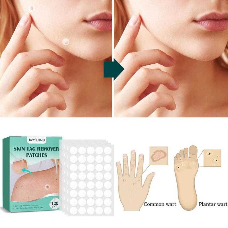 JAYSUING Stiker Penghilang Kutil Tahi Lalat Wart Removal Patch 120 PCS - JY12