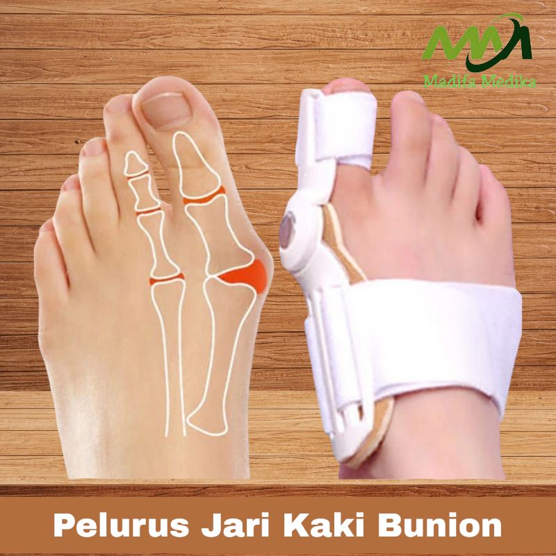 Alat Korektor  Pelurus Jari Kaki Hallux Valgus  Bunion  Hallux Valgus