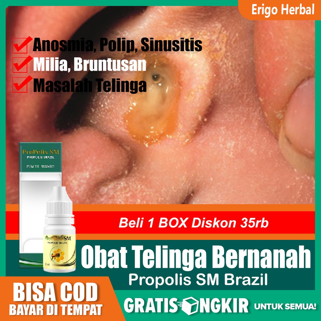 Obat Telinga Bernanah, Congek, Curek, Telinga Berair, Infeksi Telinga Propolis SM Tangerang
