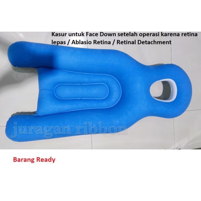 Ablasio retina / Retinal Detachment kasur untuk face down pillow