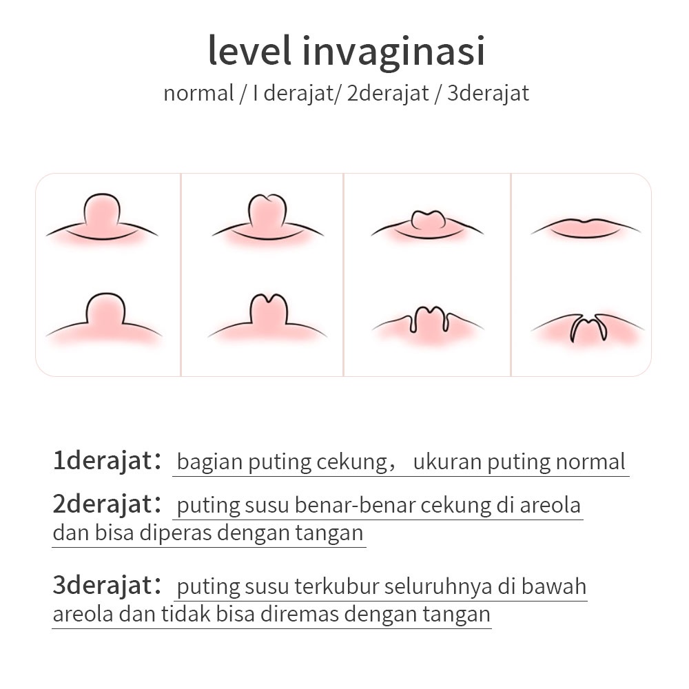 RK VICTOKY Nipple puller/Penarik puting payudara/Alat penarik puting