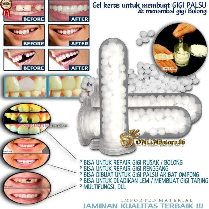 Gigi Palsu Bikin Sendiri | Lem Tambalan Penambal lobang retak instan