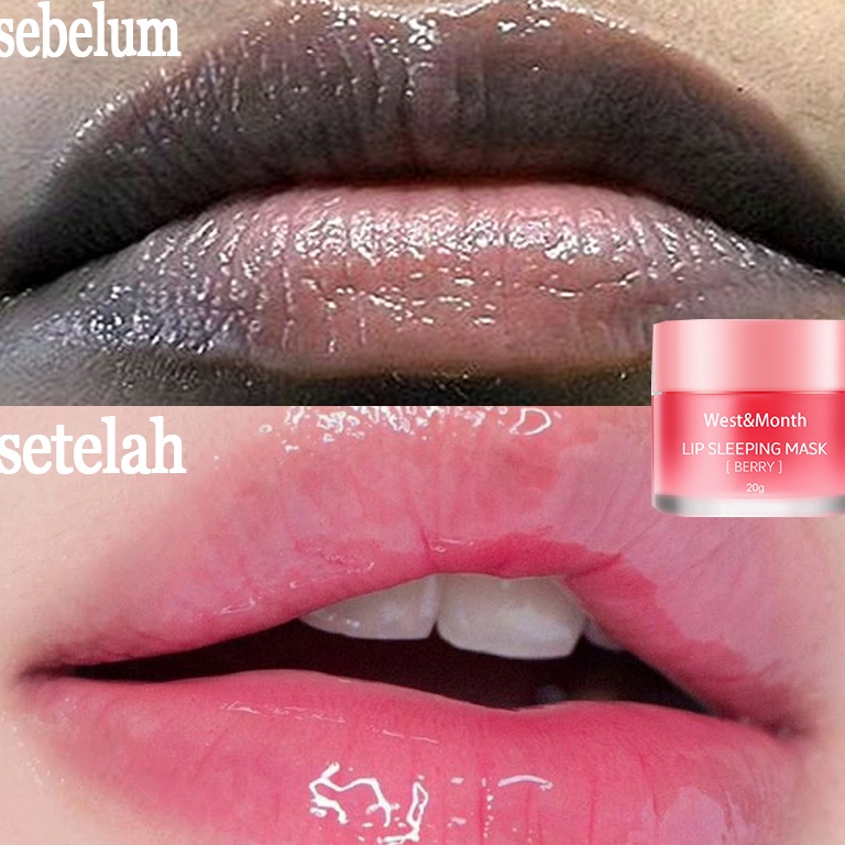 [R✪NC/✯> Penghilang bibir hitam Perawatan bibir hitam dan kering Serum bibir hitam Pemerah bibir hit
