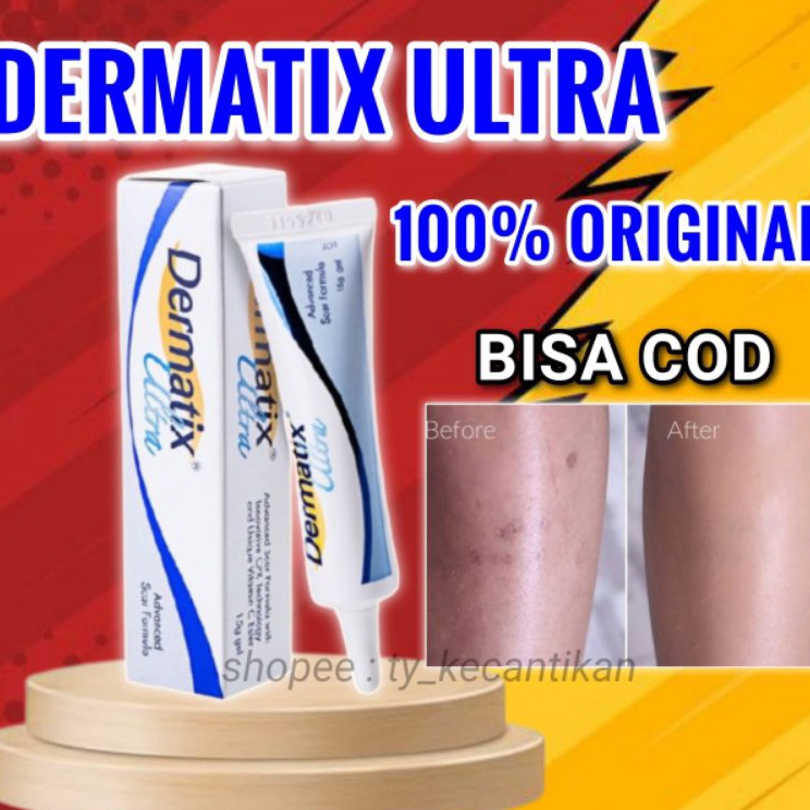 ❆Terkini❉➤ DERMATIX ULTRA ORIGINAL / DERMATIX ULTRA PENGHILANG BEKAS LUKA / DERMATIK PENGHILANG BEKA