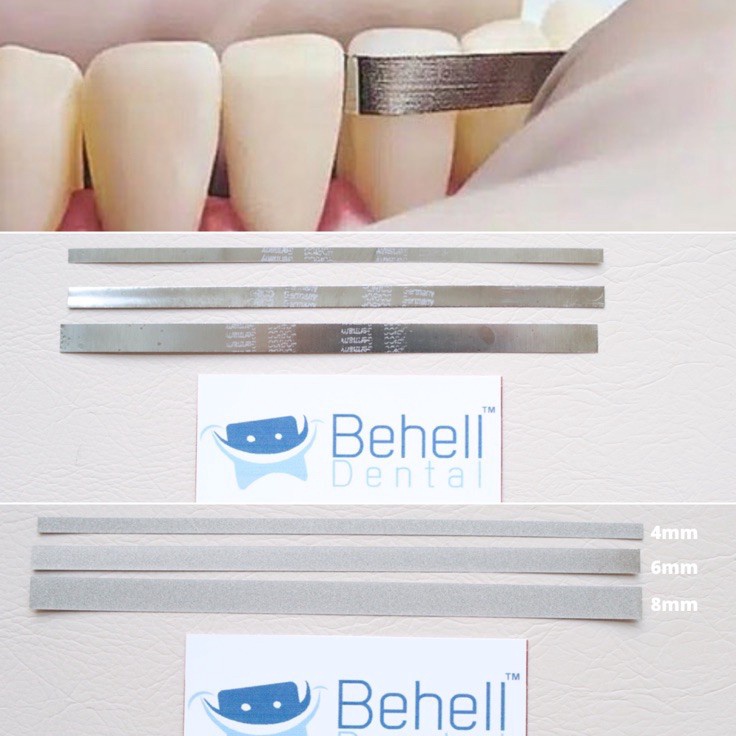 ☈Kirim Langsung➼ Kikir Gigi Dental Abrasive Strip Steelcarbo strip Horico . Polishing Finishing peng