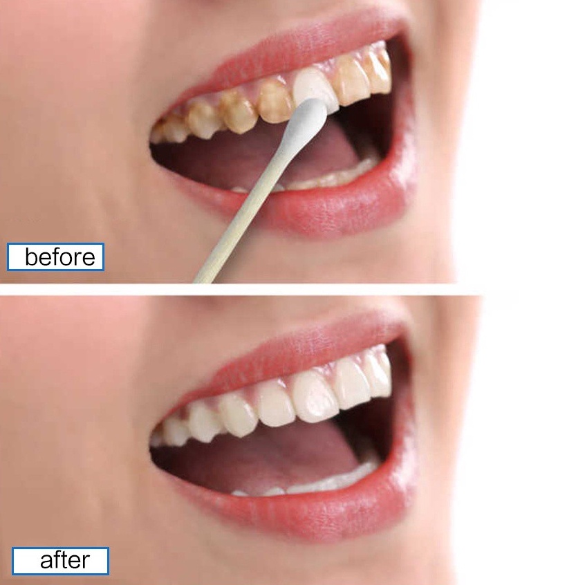 ➮Ready➮ PEMUTIH GIGI EFERO TEETH WHITENING ESSENCE PENGHILANG KARANG GIGI C60