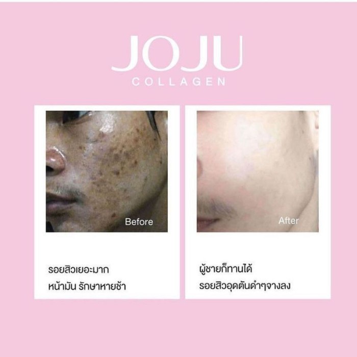 CL 12+ PRIME JOJU COLLAGEN WHITENING BRIGHTENING PEMUTIH ORIGINAL