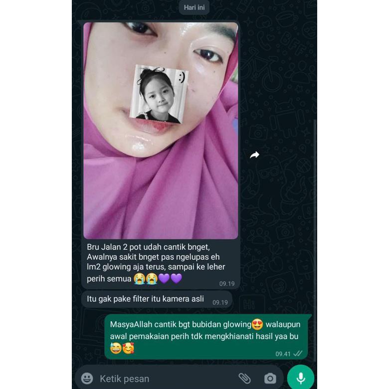 Terlaris cream thailand as pemutih wajah cream jerawat batu dan penuaan ,.