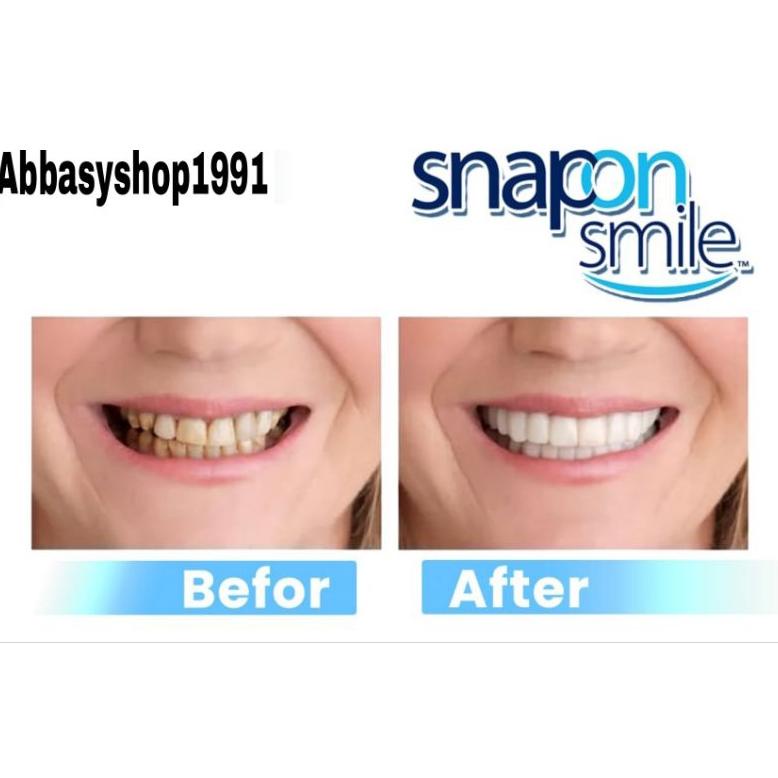 Berkualitas SNAP ON SMILE GIGI PALSU ORIGINAL SILICONE 