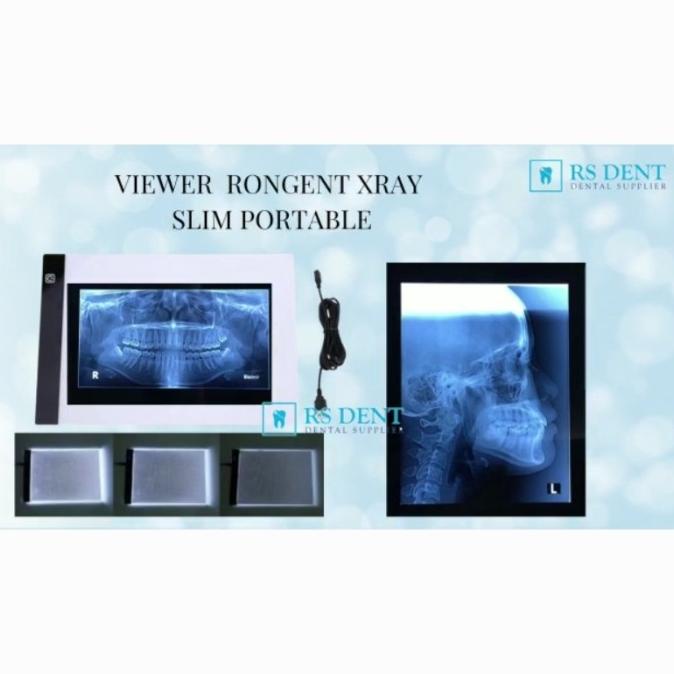 Viewer Rongent Xray Slim Portable