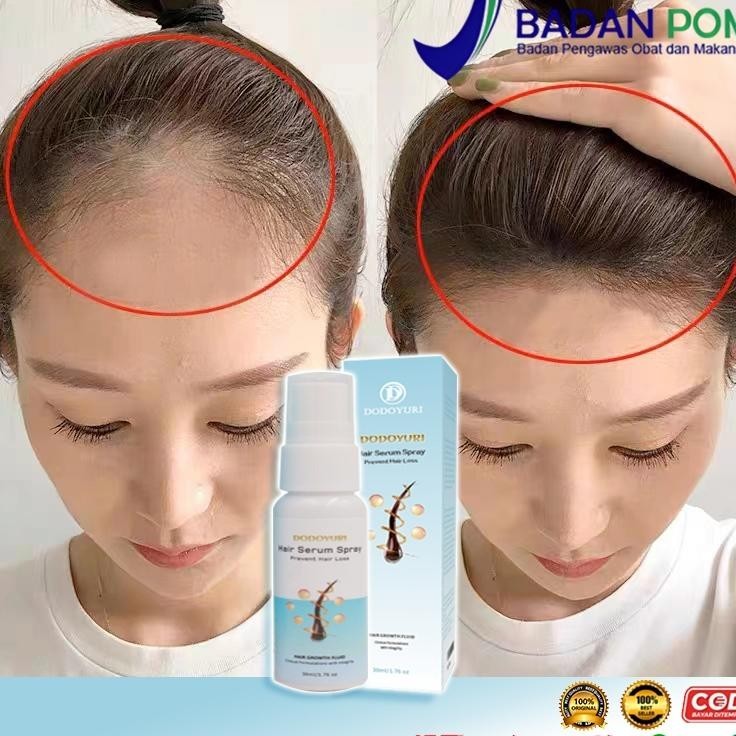 BpomObat Umbuh Rambut Umbuh Rambut Cepat Hair Growth Serum 30Ml Ebal Rambut Umbuh Rambut Botak Vitan