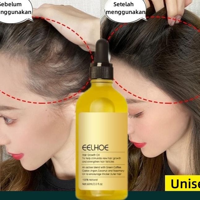 Rosemary Oil Rambut Umbuh Rambut Botak Perawatan Rambut Rontok Umbuh Rambut Cepat Hair Growth Oil Un