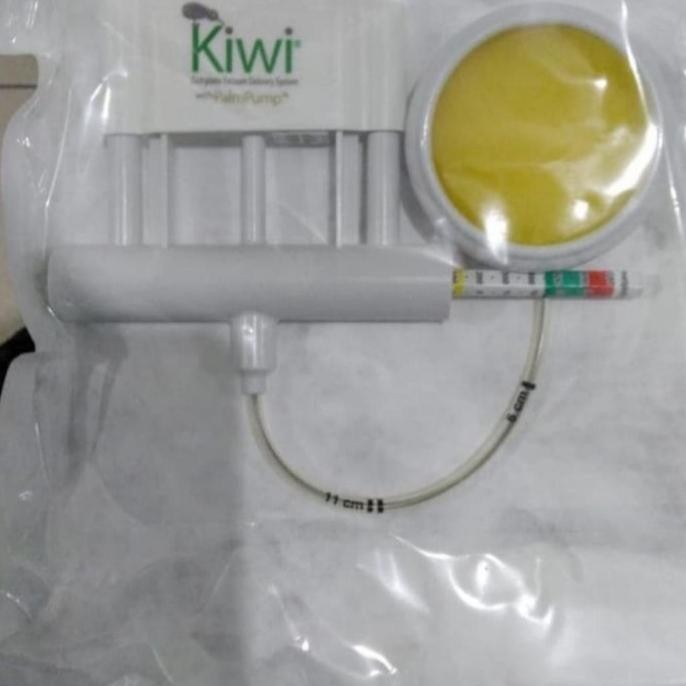 Vakum Kiwi, Alat Untuk Vakum Bayi