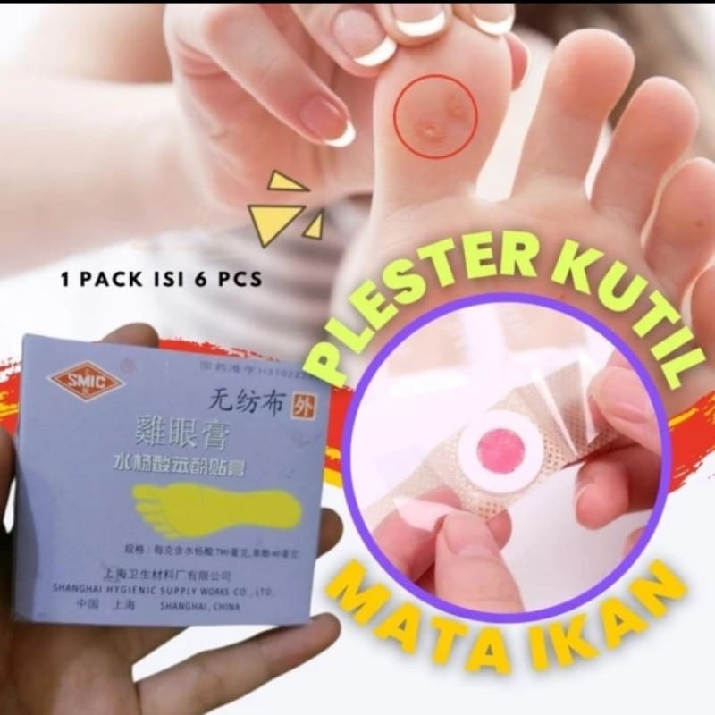 Plester Kutil Mata Ikan Kaki Kapalan Ji Yan Gao 0bat Kutil Mata Ikan  - 1 pack 2 pcs Terlaris