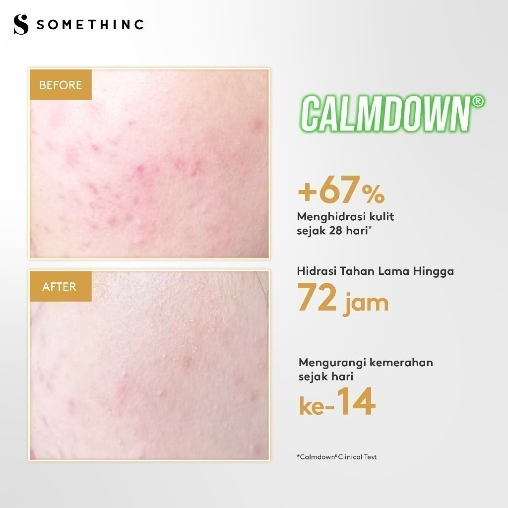 [TASYA FARASYA APPROVED] SOMETHINC Calm Down! Skinpair R-Cover Cream Moisturizer - (Madagascar Centella Asiatica, Skin Barrier, Kulit Sensitif, Kulit Iritasi) Image 6