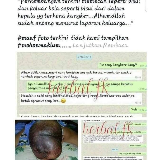 

Teh Herbal FK H24ID