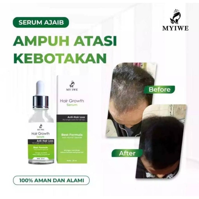 MY IWE HAIR GROWTH SERUM - SERUM PENUMBUH RAMBUT