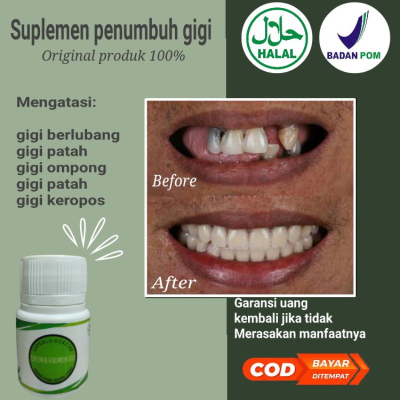 SUPLEMEN PENUMBUH GIGI BOLONG,PATAH,BERLUBANGAMPUH ORIGINAL 100%