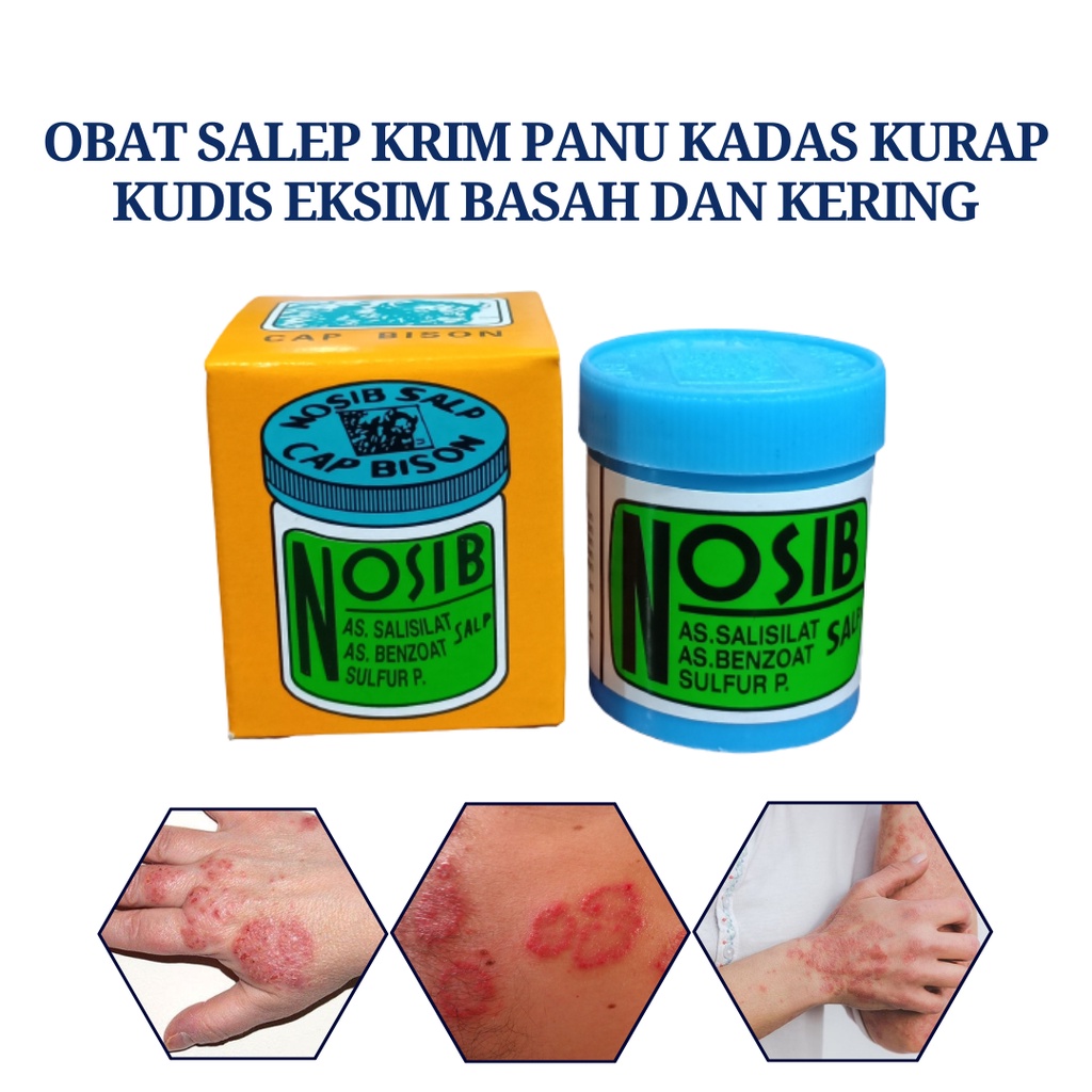 Salep Kurap Panu Kulit Gatal Gatal Obat Selangkangan Jamur Eksim Basah Dan Kering Menahun Ruam Kulit