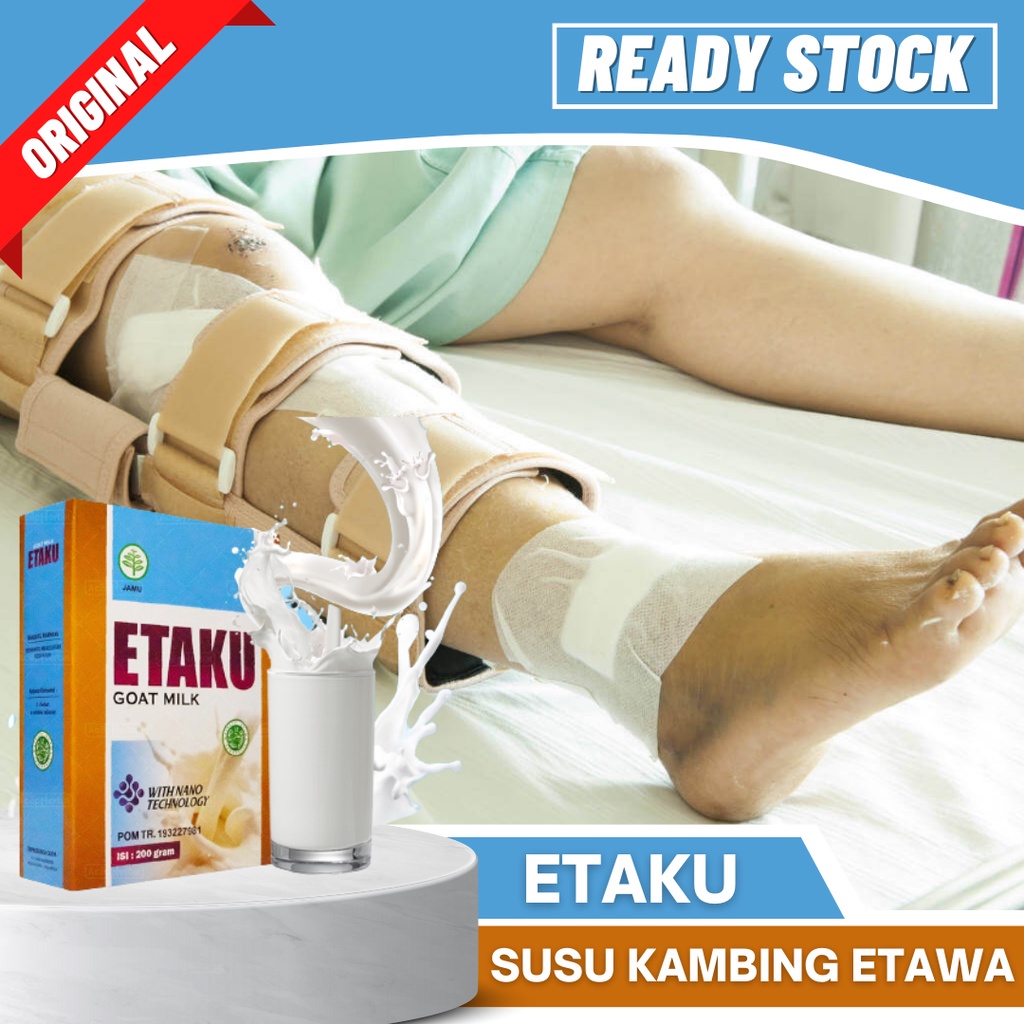 

Susu Untuk Patah Tulang, Gapuran Tulang, Tulang Retak, Keropos, Rapuh, Susu Percepat Yembuhan Patah