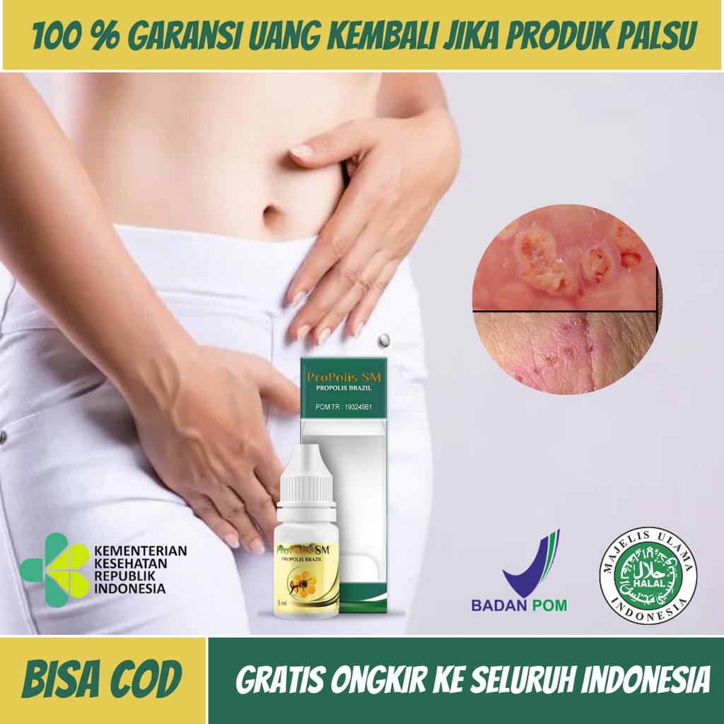 Obat Vagina Lecet, Obat Vagina Gatal, Obat Vagina Becek, Obat Miss v Gatal Dan Perih, Obat Miss V Le