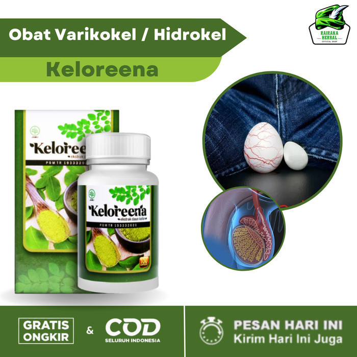 

Obat Varikokel Nyeri Testis, Buah Zakar Bengkak, Hidrokel - Keloreena