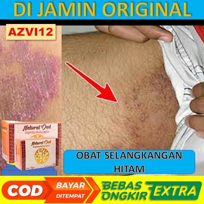 Obat Selangkangan Hitam Pemutih Selangkangan Hitam Membandel
