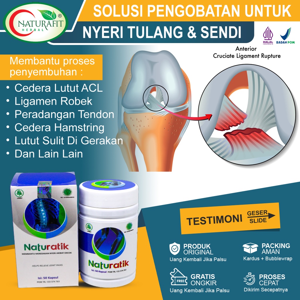 Obat Cedera ACL Paling Ampuh, Vitamin Otot Ligamen Robek, Anterior Cruciate Ligament, Penguat Otot L