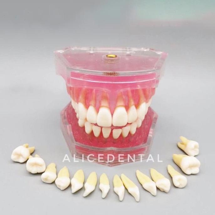 Dental Study Model Gigi Typodont Phantom Studi Bisa Dilepas Gusi Karet Kode 283