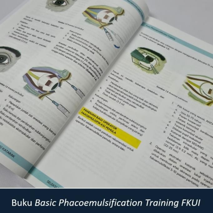 

New Buku Basic Phacoemulsification Training Fkui Pengiriman Cepat