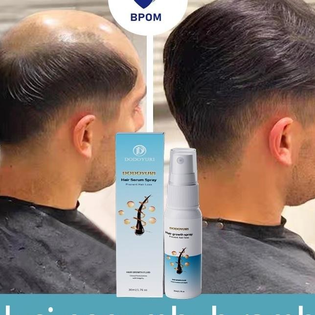 [Bpom] Umbuh Rambut Cepat Obat Umbuh Rambut Serum Umbuh Rambut Umbuh Rambut Botak 30Ml Kontrol Nyak 