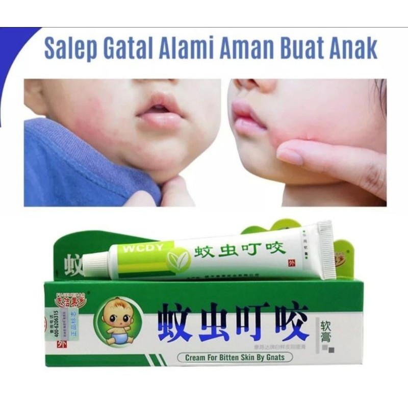 ( ACEH TIMUR) SALAP GATAL AMPUH KHUSUS BAYI / ANAK