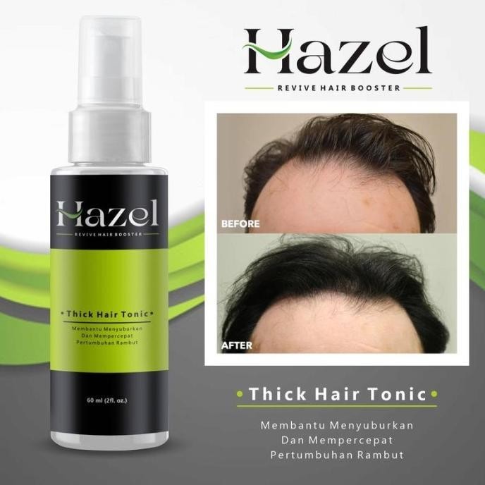 Flash Sale Penumbuh Rambut Kebotakan - Penumbuh Rambut Cepat | Hazel Hair Tonic ,.