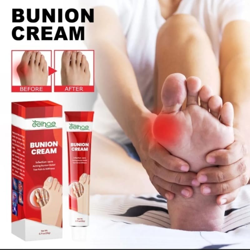 EELHOE CREAM BUNION Salep Nyeri Sendi Jari Kaki Kaku Akibat Bunion 20g Terlaris