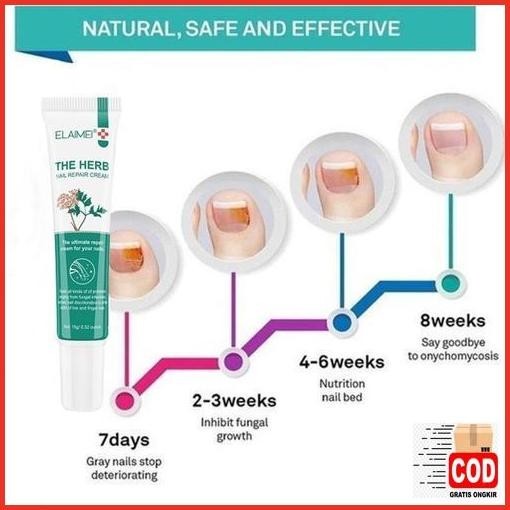 Cuci Gudang Elaimei Obat Jamur Kuku 15G Perawatan Kuku Jamur Kuku Cairan Obat Infeksi Kuku Anti Jamu