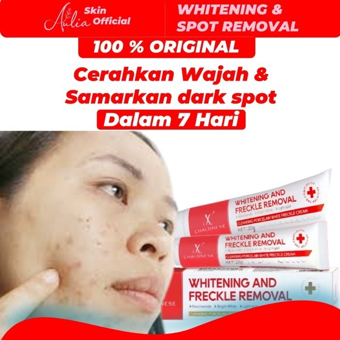 CHALONESE WHITENING AND FRECKLE REMOVAL KRIM FLEK HITAM PEMUTIH WAJAH