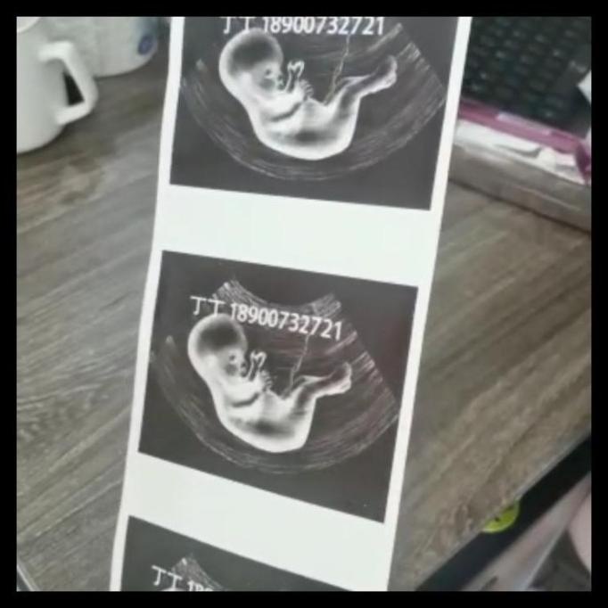 

Thermal Paper Usg Kertas Sony Upp 110 Hg 1 Pack Isi 10 Roll