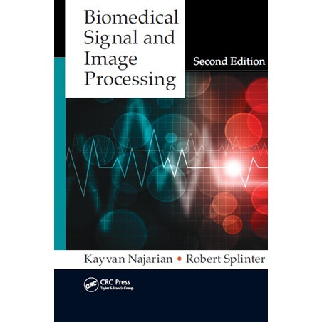 

Biomedical Signal and Image Processing [2 ed.] Kayvan Najarian, Robe