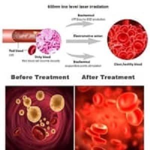NEW JAM TANGAN TERAPI LASER KESEHATAN 7 TITIK UNTUK DIABETES ORIGINAL TERBARU